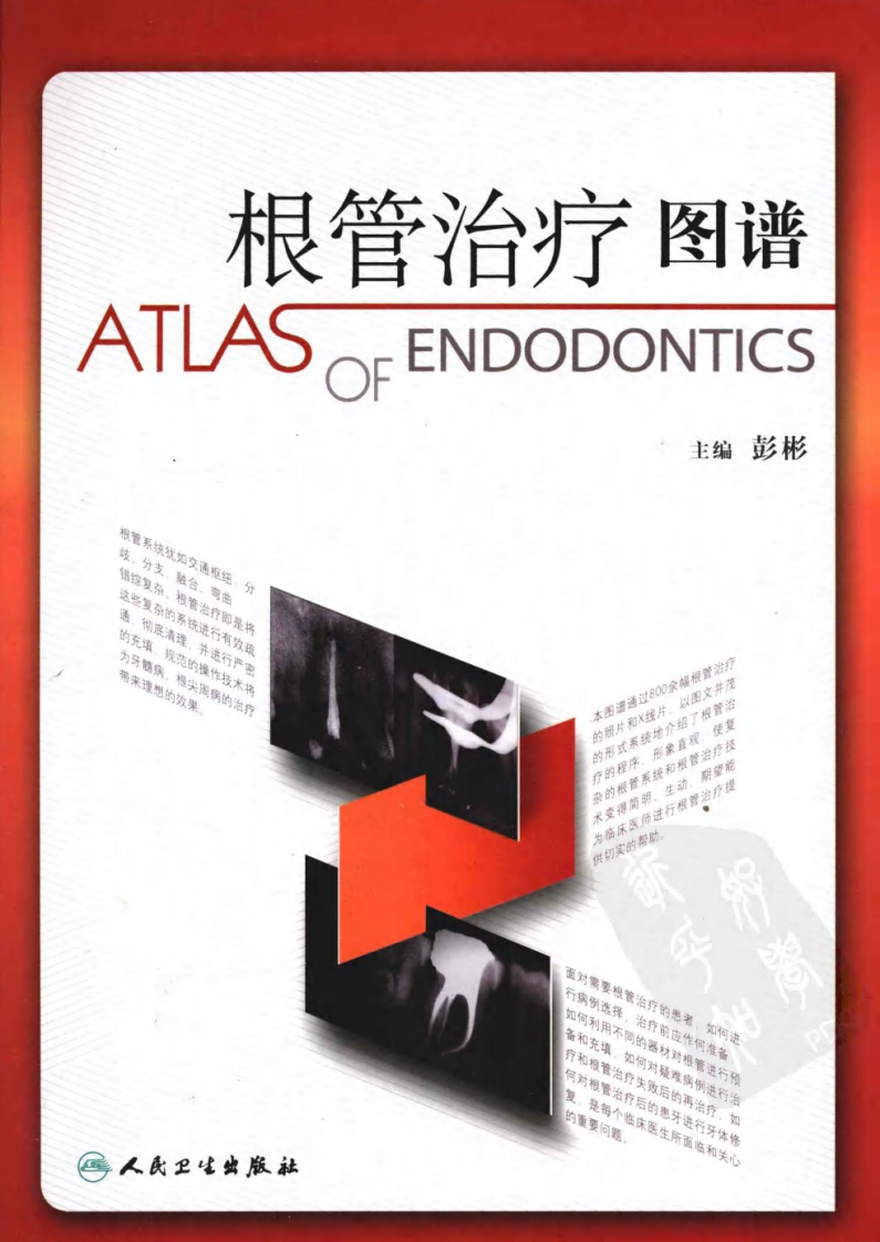 根管治疗图谱.pdf 第1页