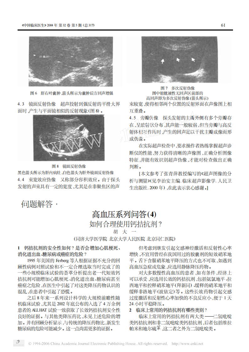 临床医生学超声第1讲超声诊断仪的成像原理和声像图分析.pdf 第3页
