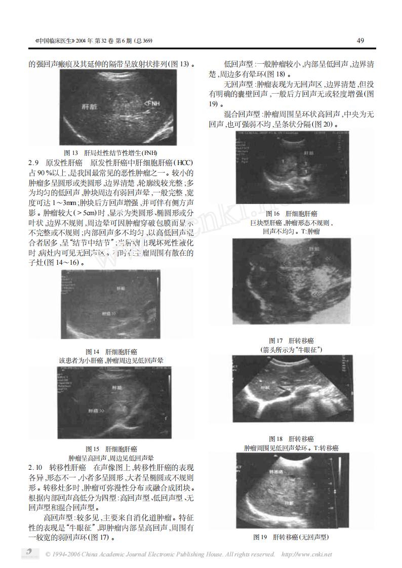 临床医生学超声第2讲肝脏疾病.pdf 第3页