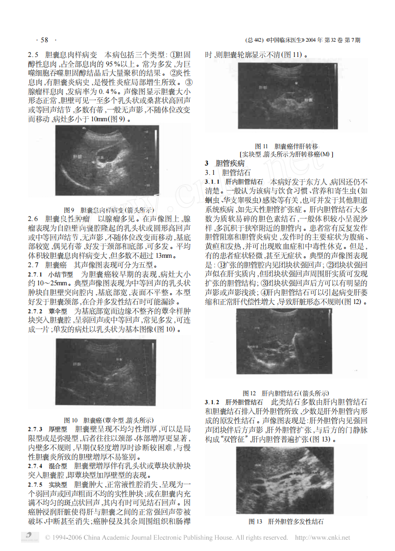 临床医生学超声第3讲胆道系统疾病.pdf 第3页