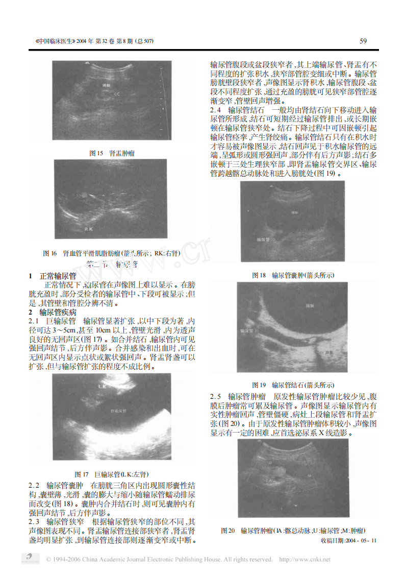 临床医生学超声第4讲肾脏输尿管疾病.pdf 第4页