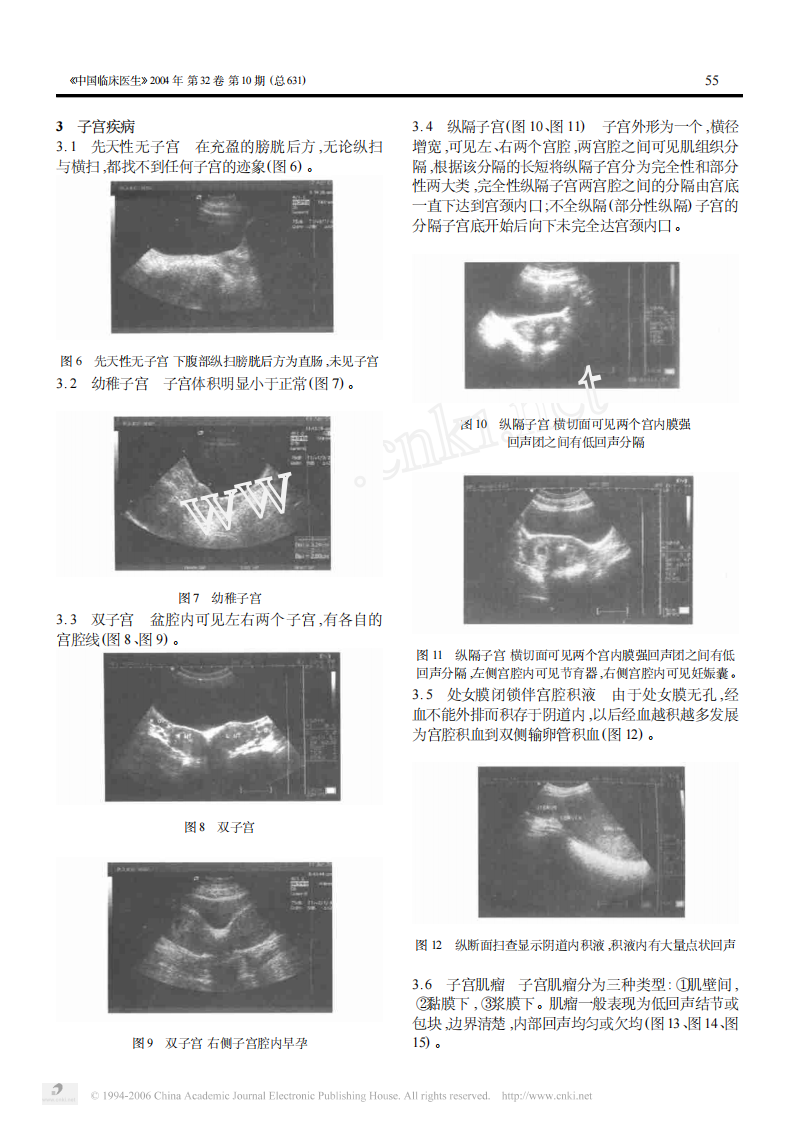 临床医生学超声第6讲子宫疾病.pdf 第2页