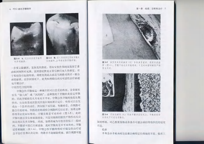 PDQ速成牙髓病学.pdf 第5页