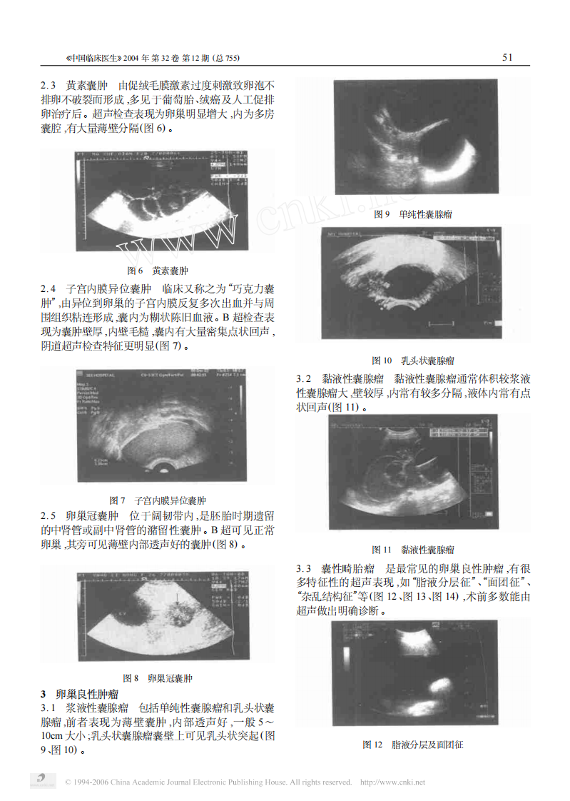临床医生学超声第7讲卵巢疾病.pdf 第2页