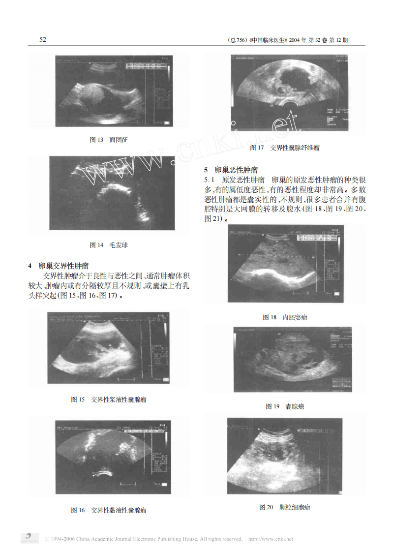 临床医生学超声第7讲卵巢疾病.pdf 第3页