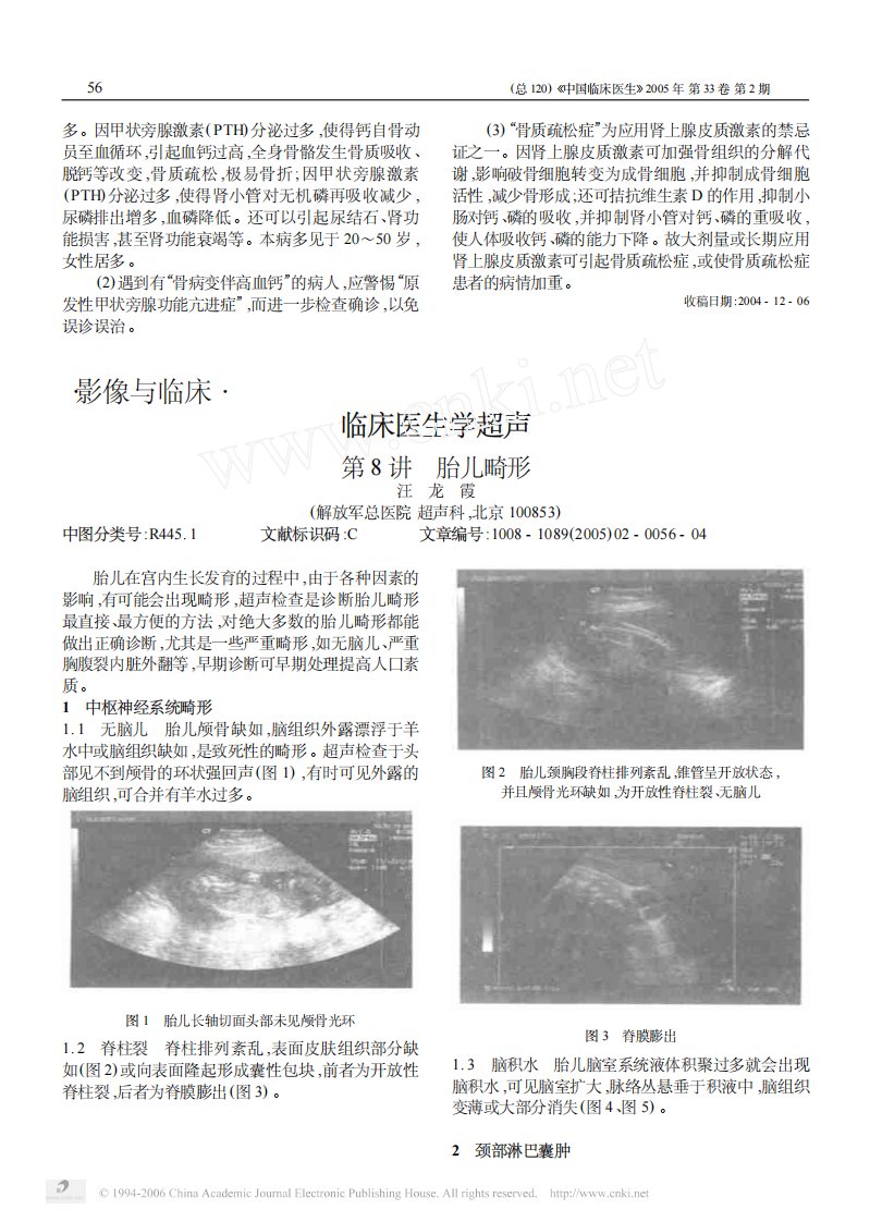 临床医生学超声第8讲胎儿畸形.pdf 第1页