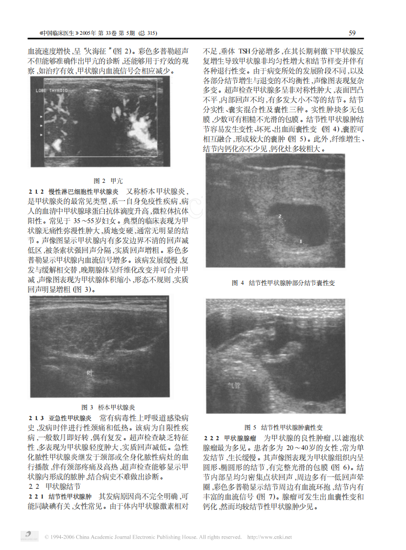 临床医生学超声第9讲甲状腺的超声.pdf 第2页