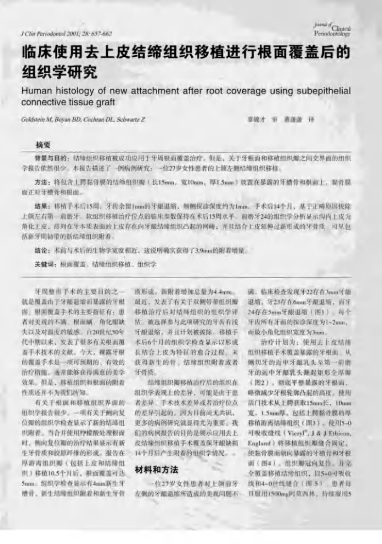 临床牙周病学  根面覆盖与牙周组织再生专辑 .pdf 第4页