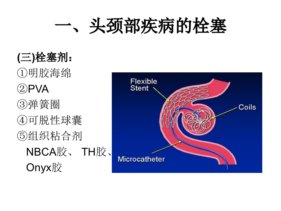 04-05 介入性神经放射学.ppt 第4页