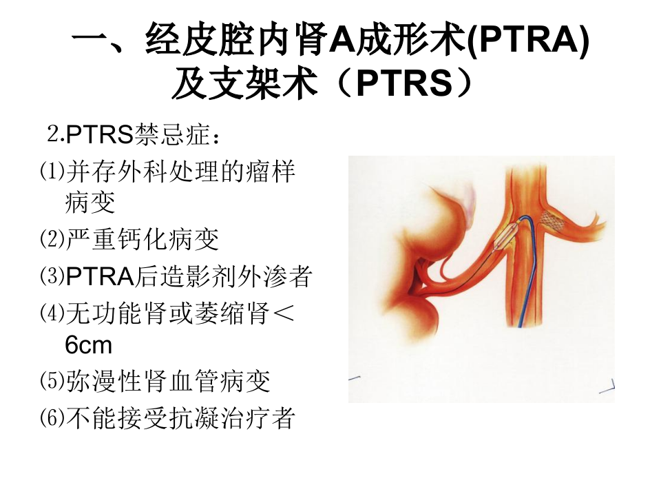 04-05 泌尿生殖系统介入放射学.ppt 第5页