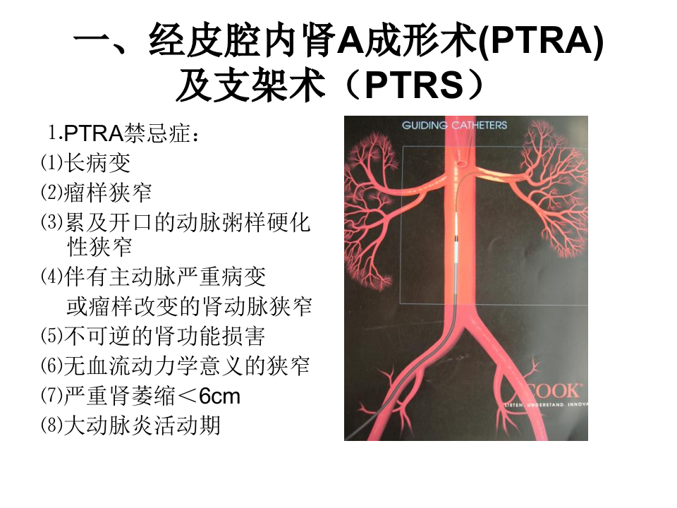 04-05 泌尿生殖系统介入放射学.ppt 第4页