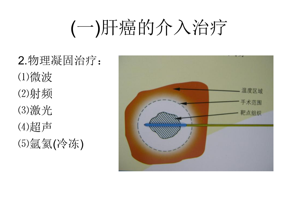 04-05 消化系介入放射学讲义.ppt 第4页