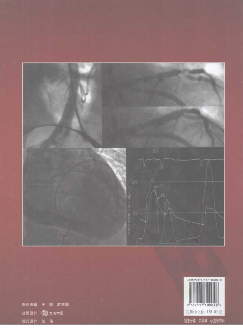 心血管介入学(第七版).pdf 第2页