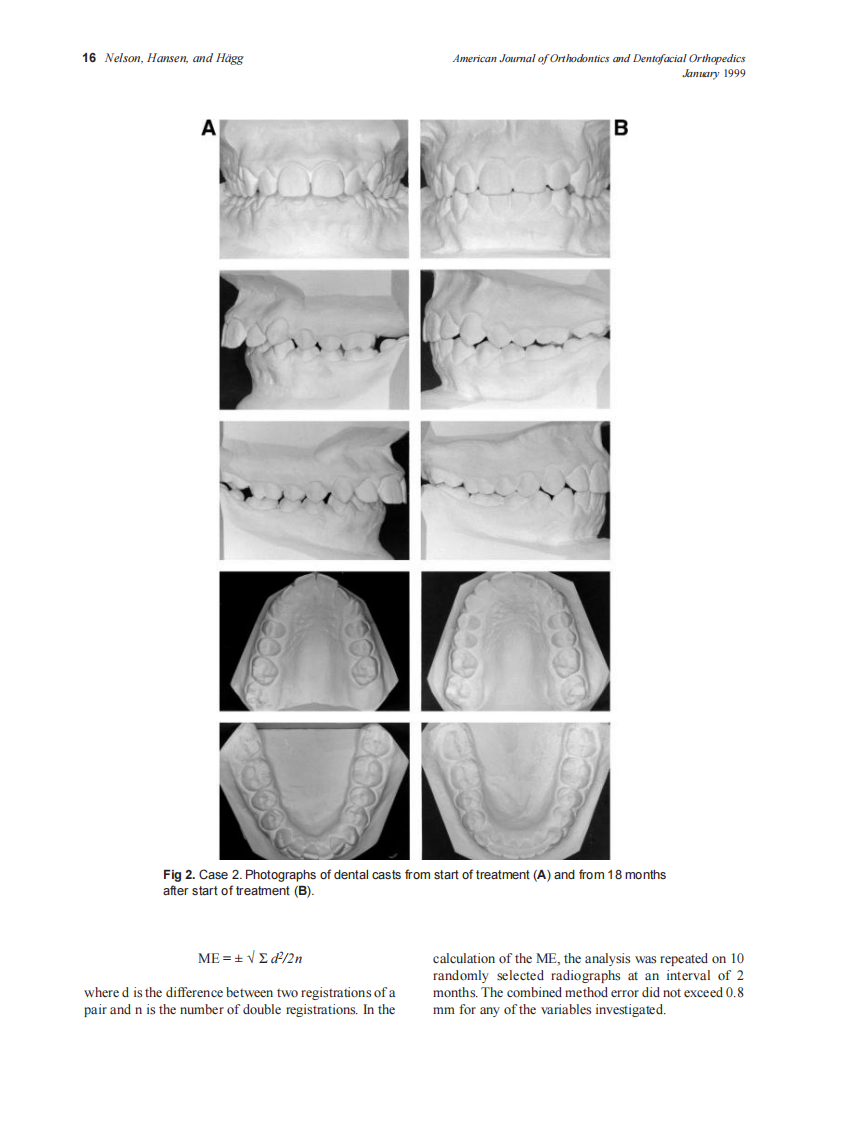 1999_115_1_13_23_Nelson.pdf 第4页