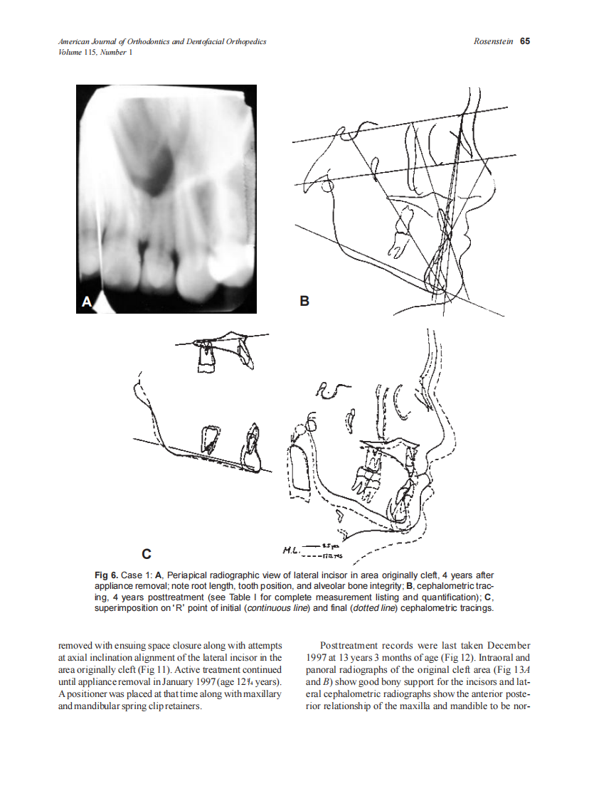 1999_115_1_61_71_Rosenstein.pdf 第5页