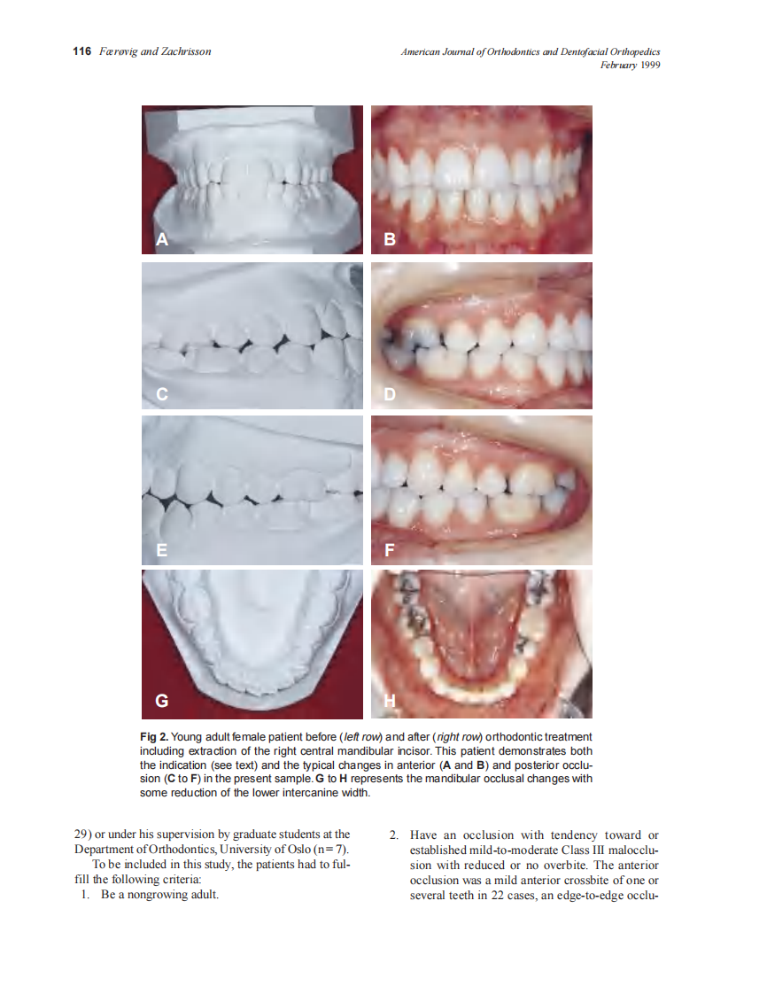 1999_115_2_113_124_Faerovig.pdf 第4页