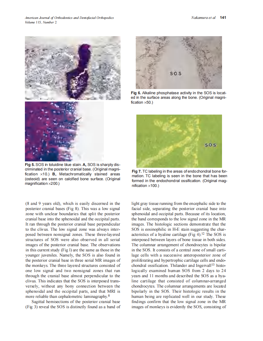 1999_115_2_138_142_Nakamura.pdf 第4页