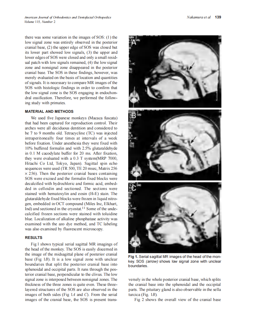 1999_115_2_138_142_Nakamura.pdf 第2页