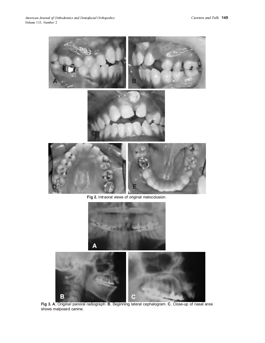 1999_115_2_148_152_Cureton.pdf 第2页