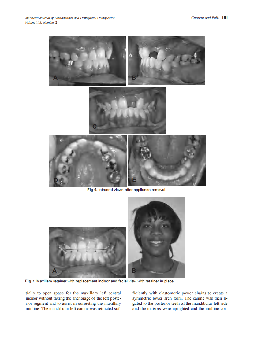 1999_115_2_148_152_Cureton.pdf 第4页