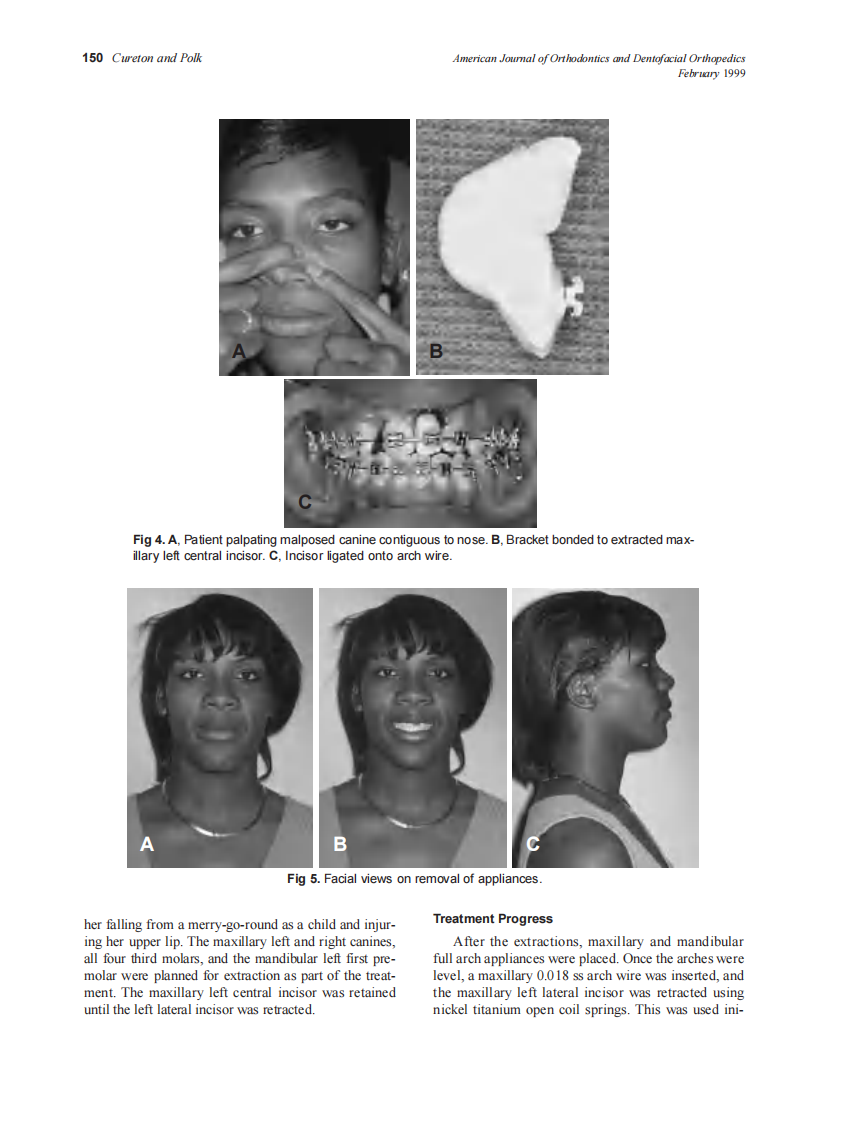 1999_115_2_148_152_Cureton.pdf 第3页