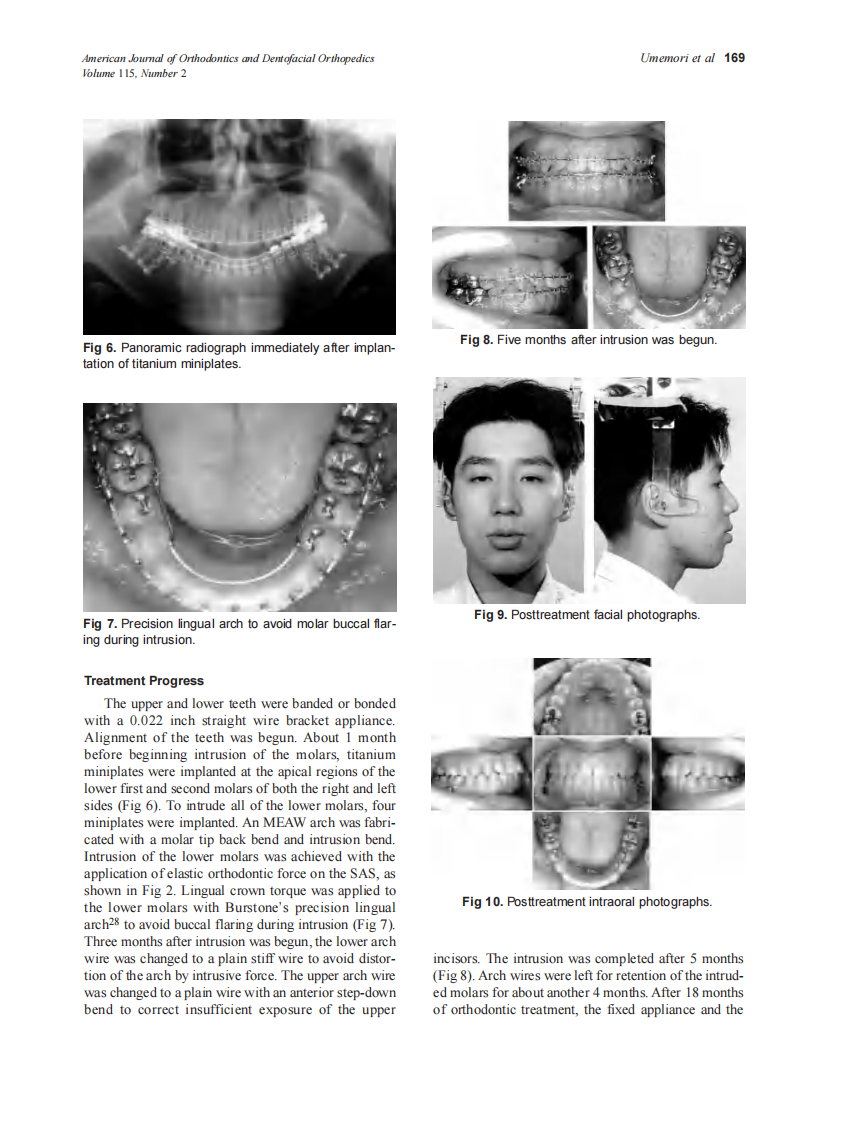 1999_115_2_166_174_Umemori.pdf 第4页