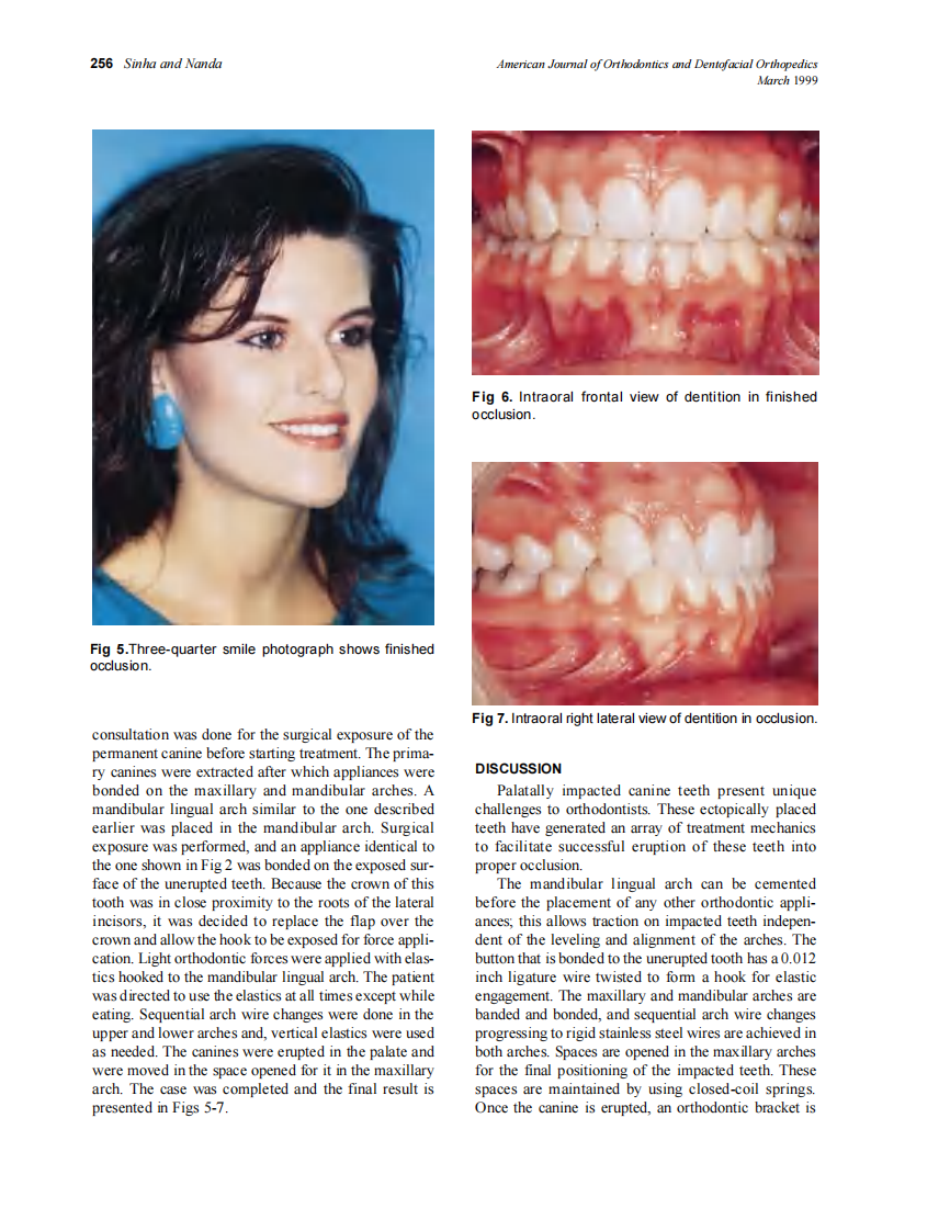 1999_115_3_254_257_Sinha.pdf 第3页
