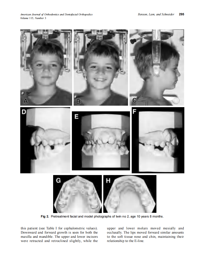 1999_115_3_293_299_Benson.pdf 第3页
