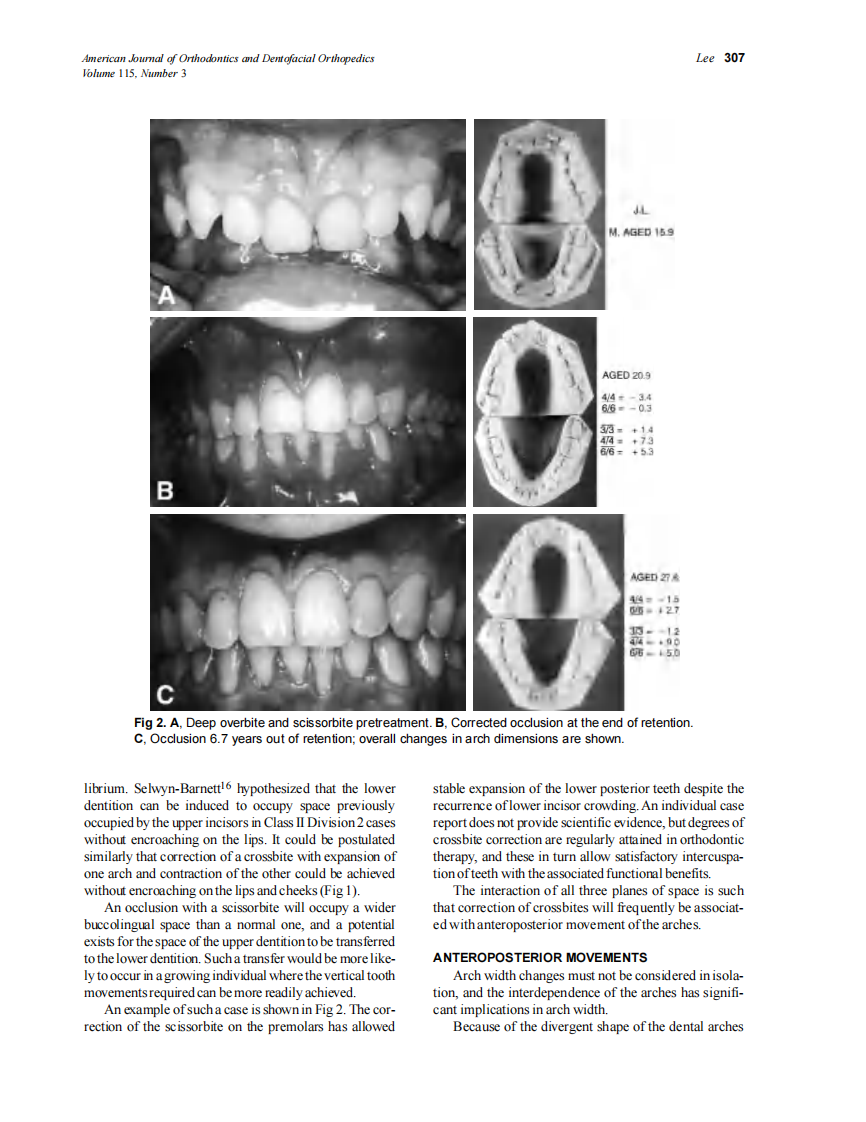1999_115_3_305_313_Lee.pdf 第3页