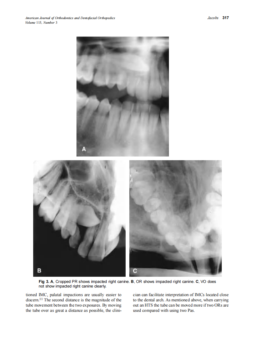 1999_115_3_314_322_Jacobs.pdf 第4页