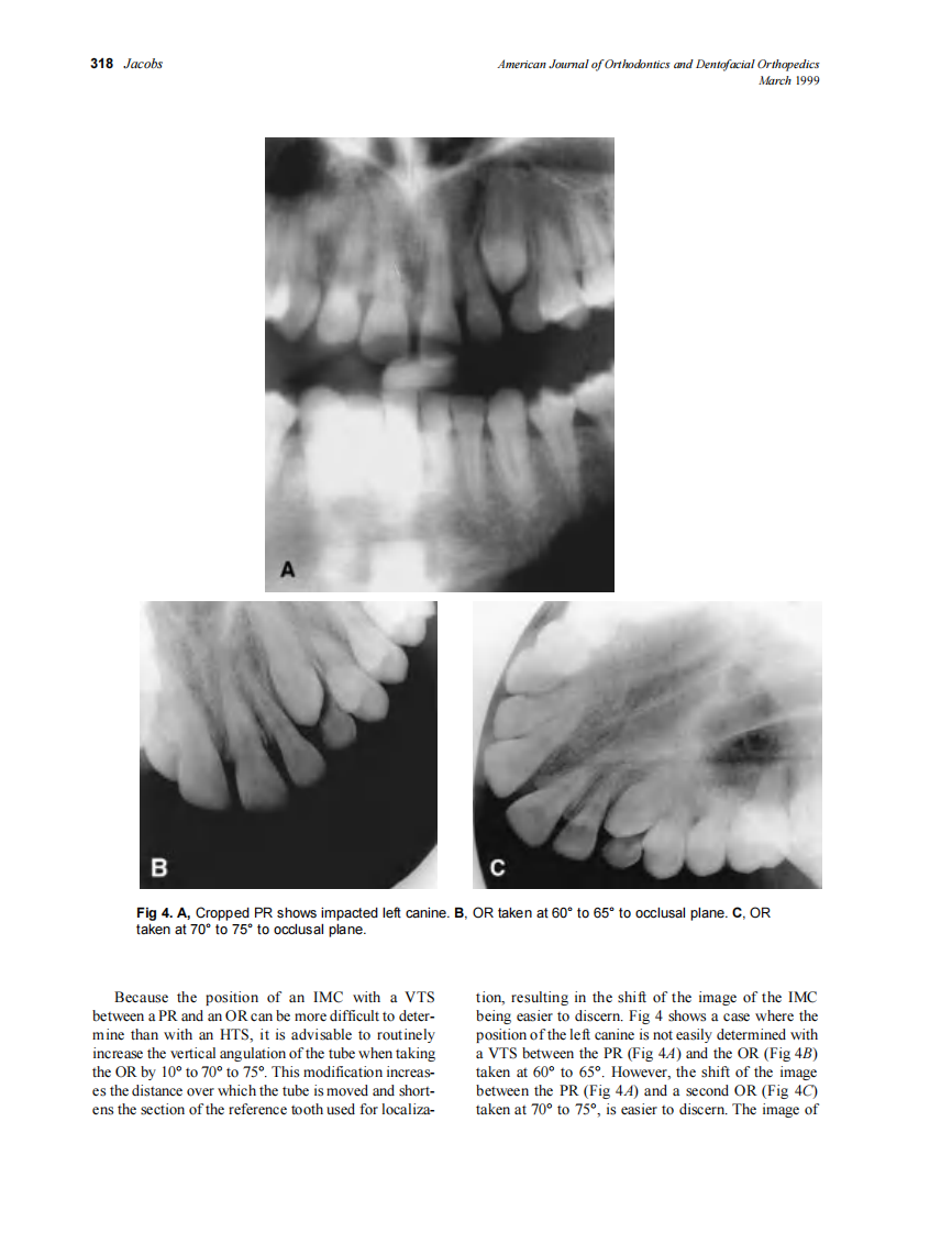 1999_115_3_314_322_Jacobs.pdf 第5页