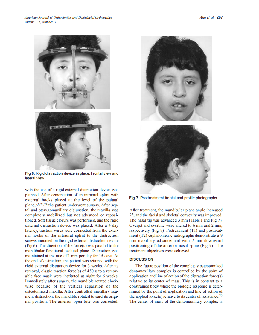 1999_116_3_264_270_Ahn_by_OrTHoTaMiNe.pdf 第4页