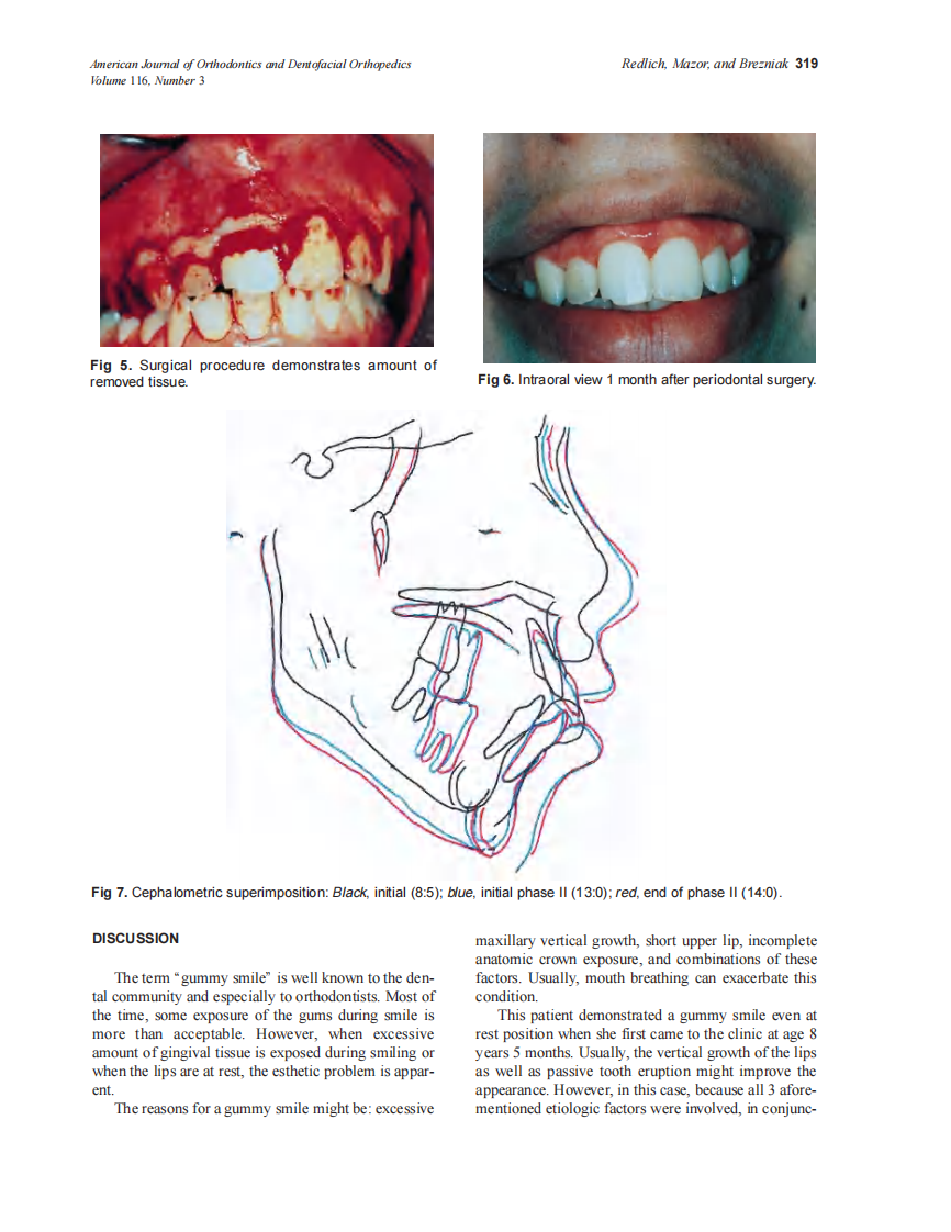 1999_116_3_317_320_Redlich_by_OrTHoTaMiNe.pdf 第3页