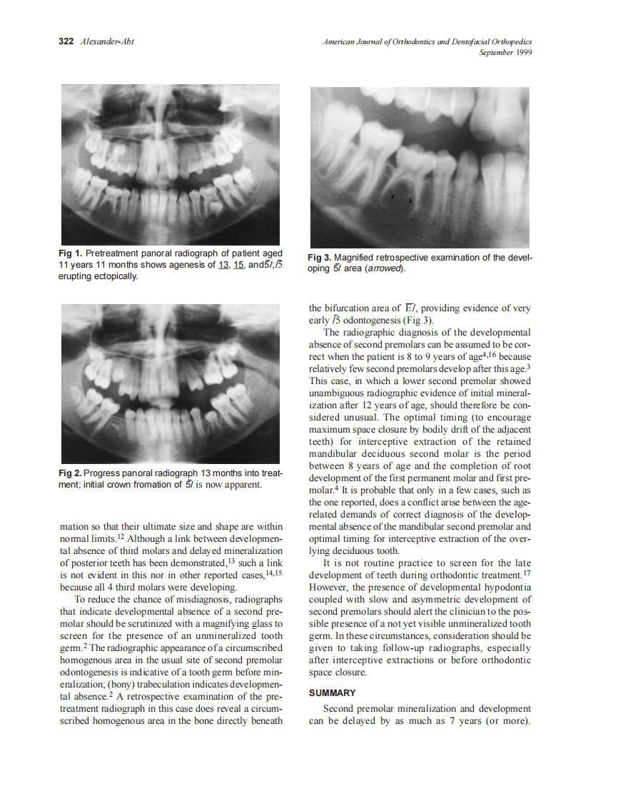 1999_116_3_321_323_Alexander-Abt_by_OrTHoTaMiNe.pdf 第2页