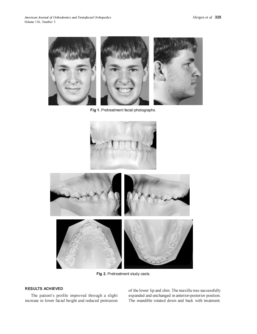 1999_116_3_324_328_Mergen_by_OrTHoTaMiNe.pdf 第2页