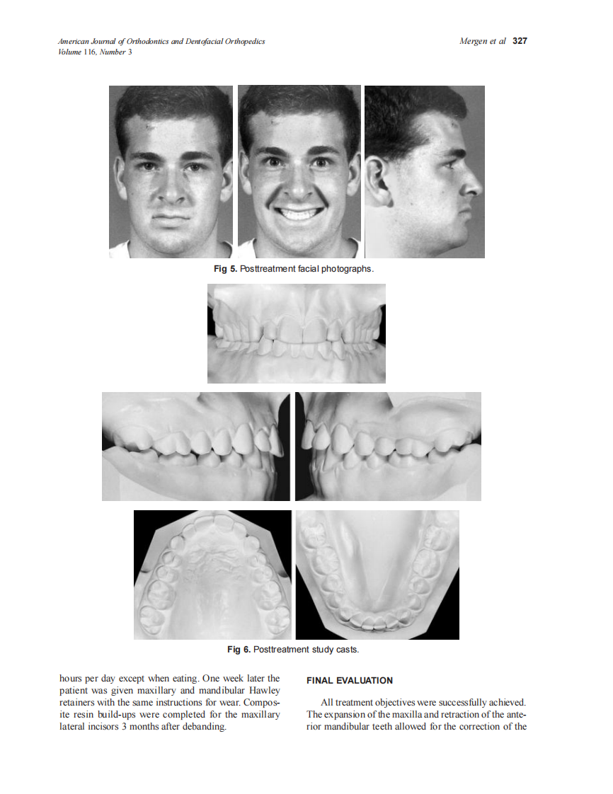 1999_116_3_324_328_Mergen_by_OrTHoTaMiNe.pdf 第4页