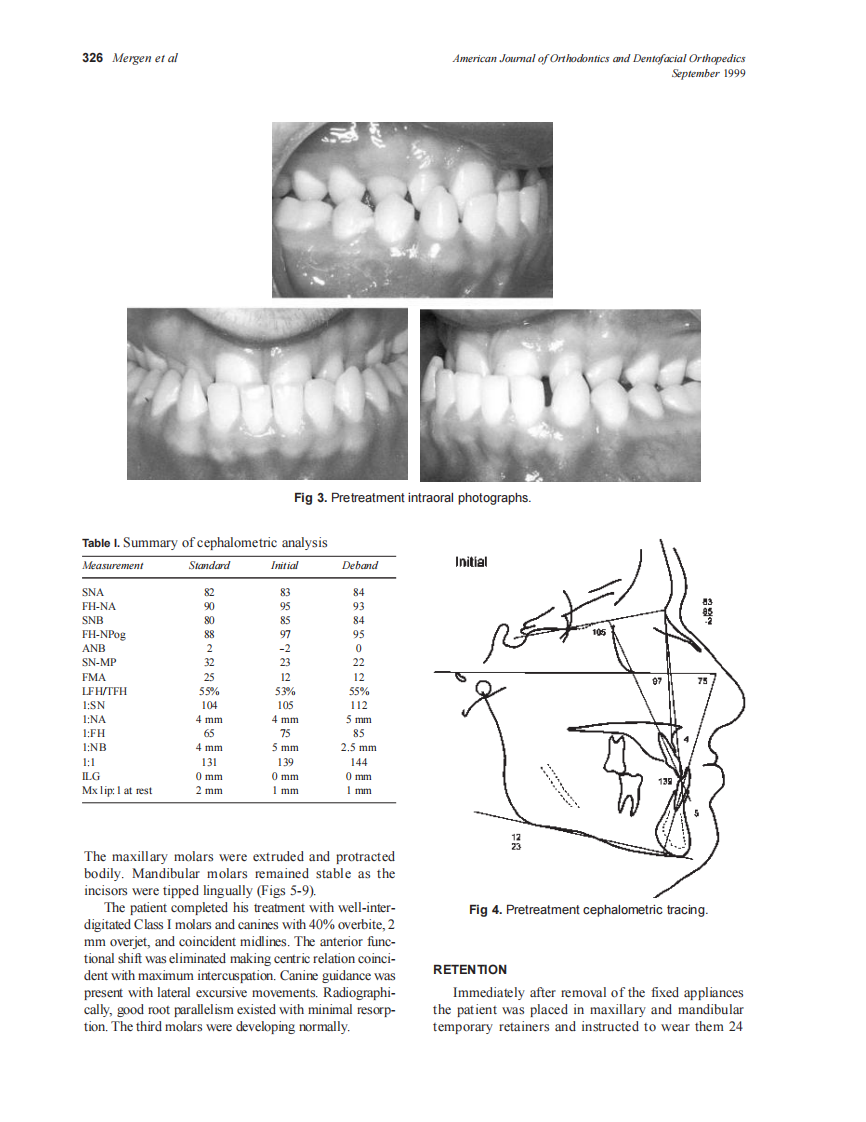 1999_116_3_324_328_Mergen_by_OrTHoTaMiNe.pdf 第3页
