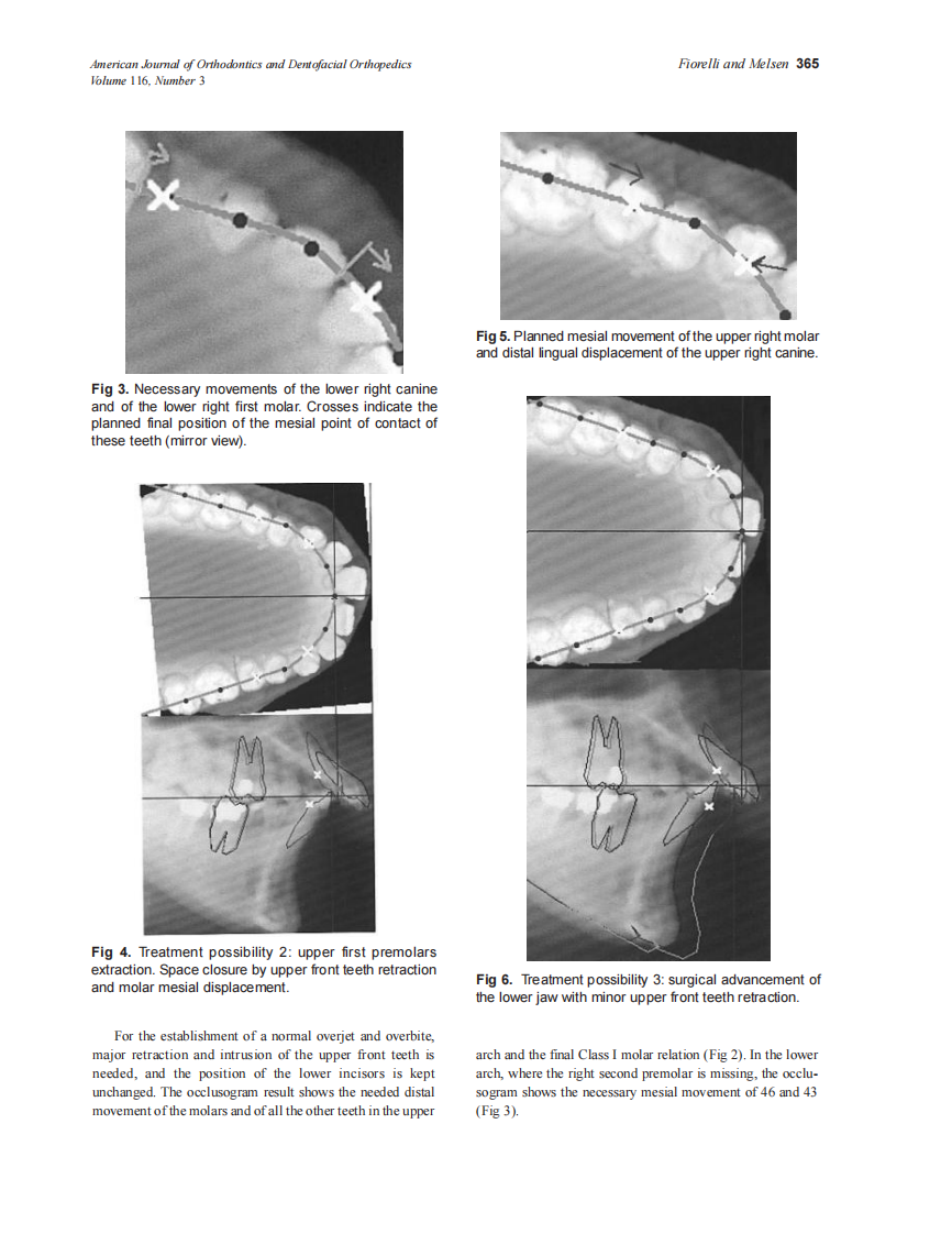 1999_116_3_363_368_Fiorelli_by_OrTHoTaMiNe.pdf 第3页