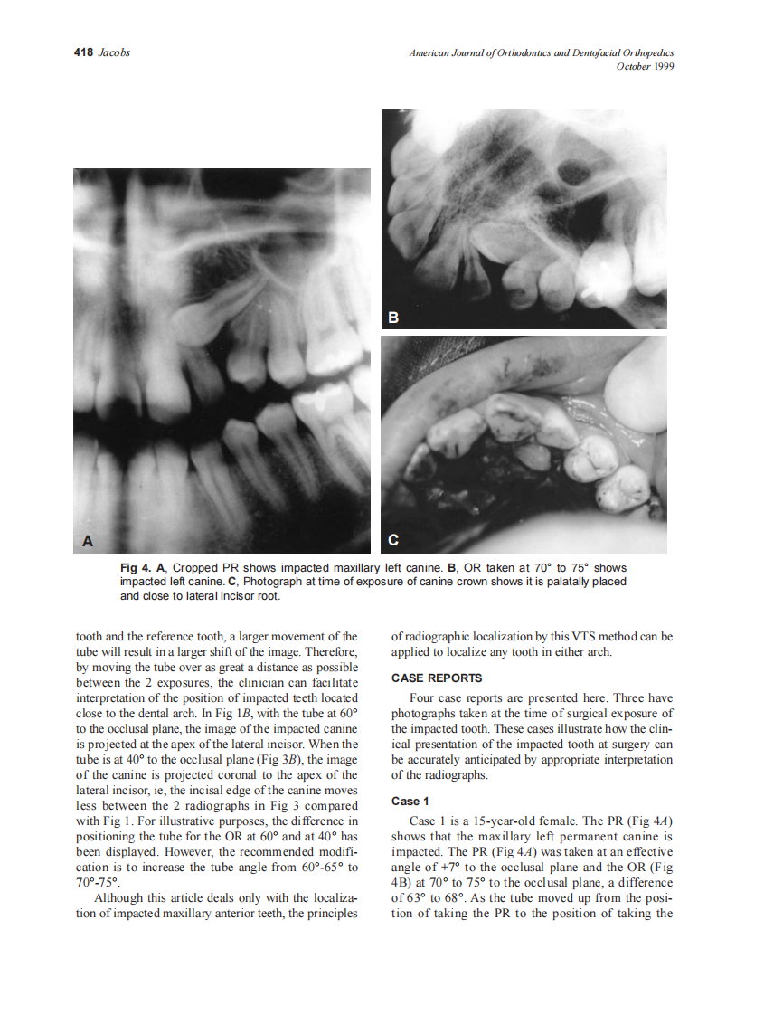 1999_116_4_415_423_Jacobs_by_OrTHoTaMiNe.pdf 第4页