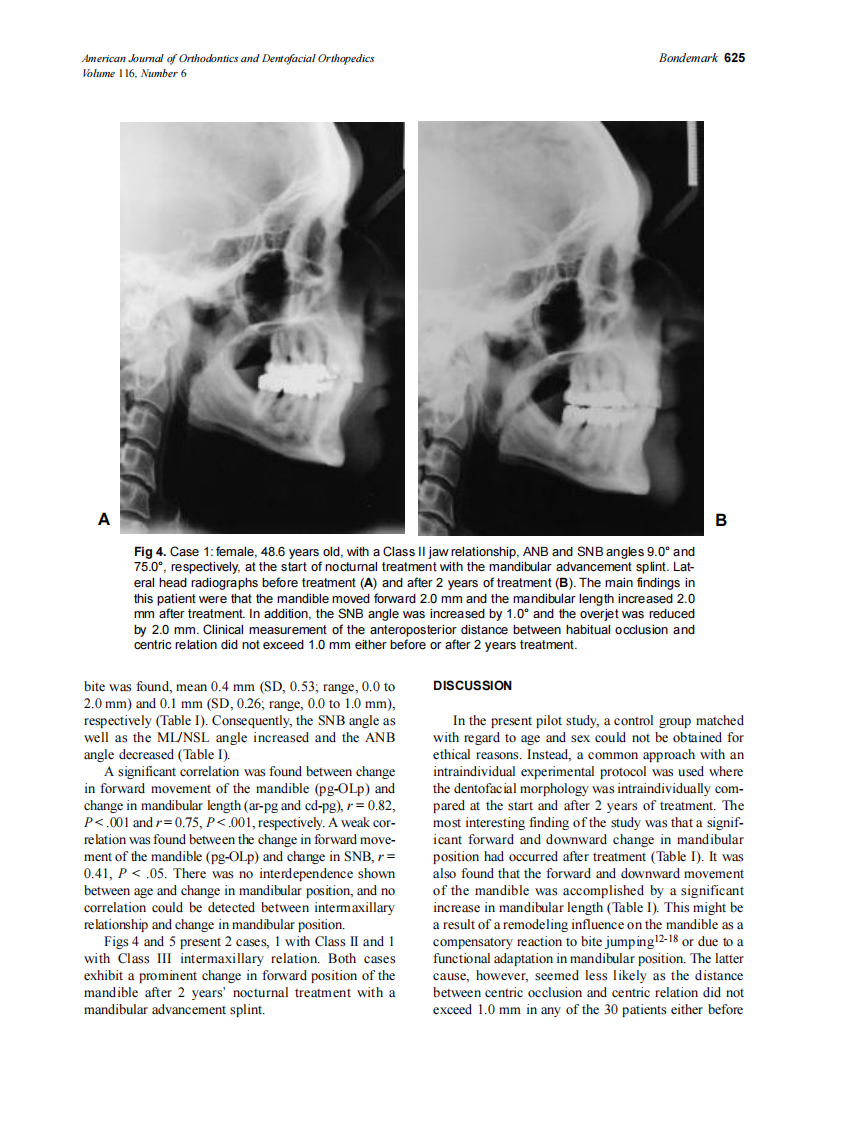 1999_116_6_621_628_Bondemark_by_OrTHoTaMiNe.pdf 第5页