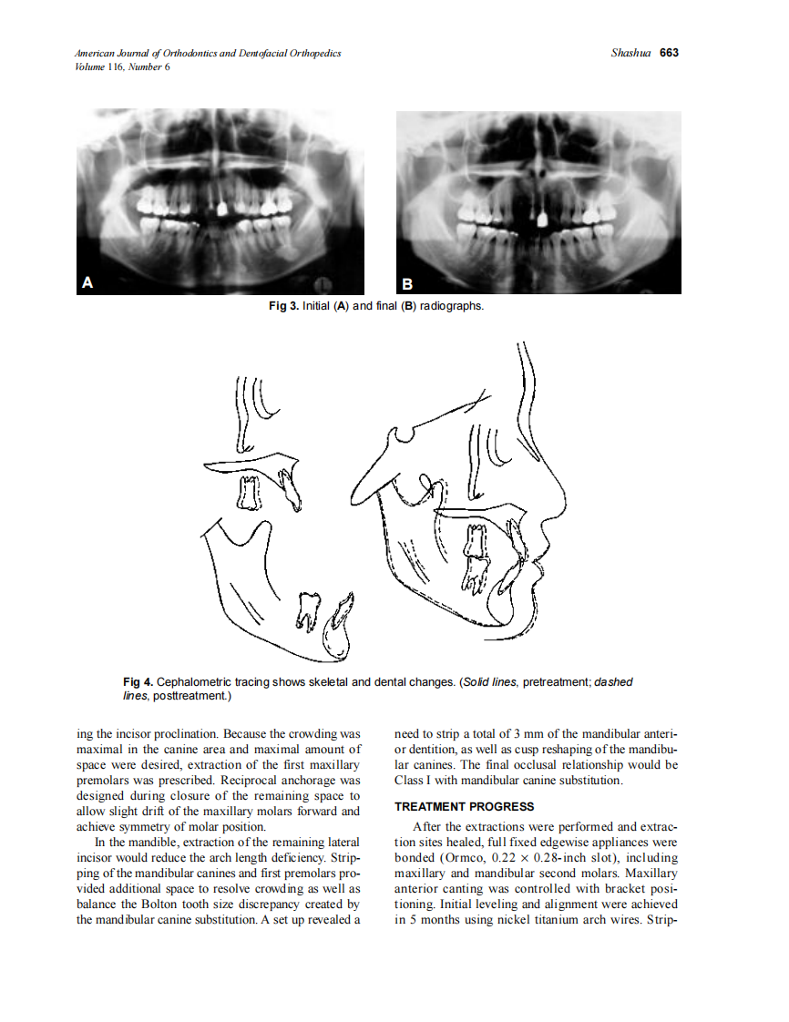1999_116_6_661_666_Shashua_by_OrTHoTaMiNe.pdf 第3页
