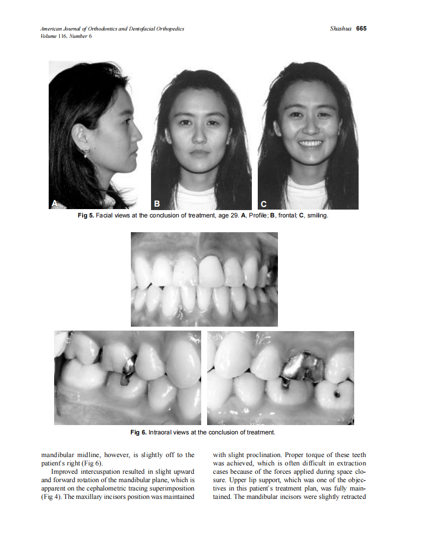 1999_116_6_661_666_Shashua_by_OrTHoTaMiNe.pdf 第5页