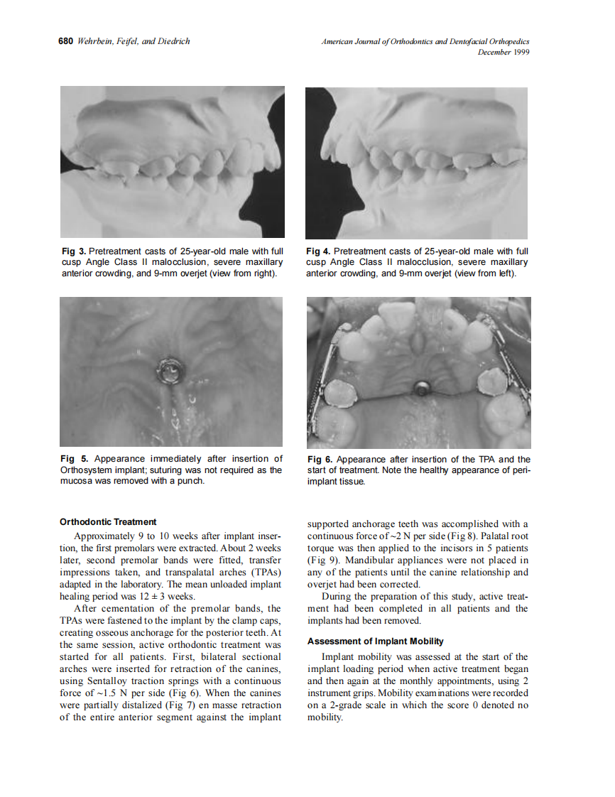 1999_116_6_678_686_Wehrbein_by_OrTHoTaMiNe.pdf 第3页