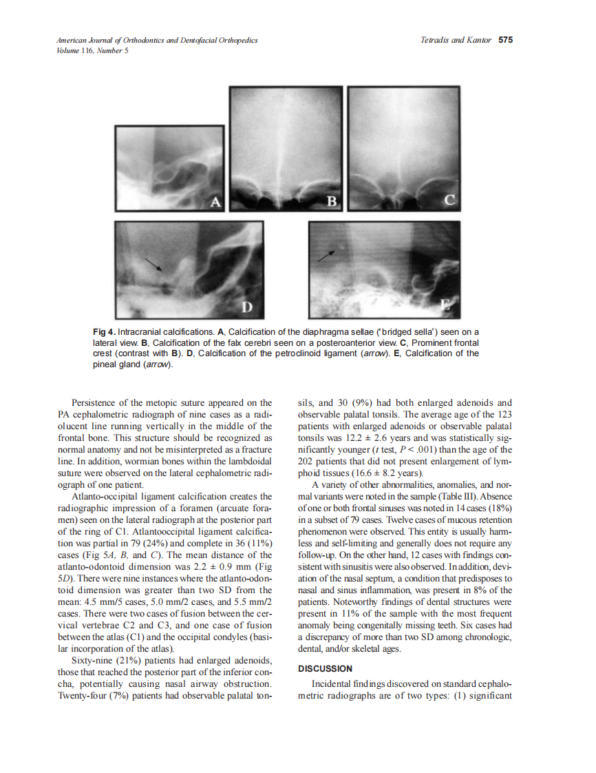 1999_sdarticle_14.pdf 第4页