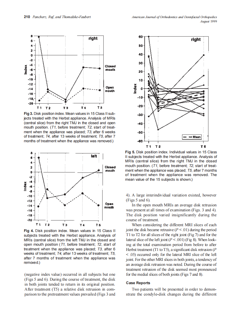 Pancherz_1999_116_2_by_OrTHoTaMiNe.pdf 第4页