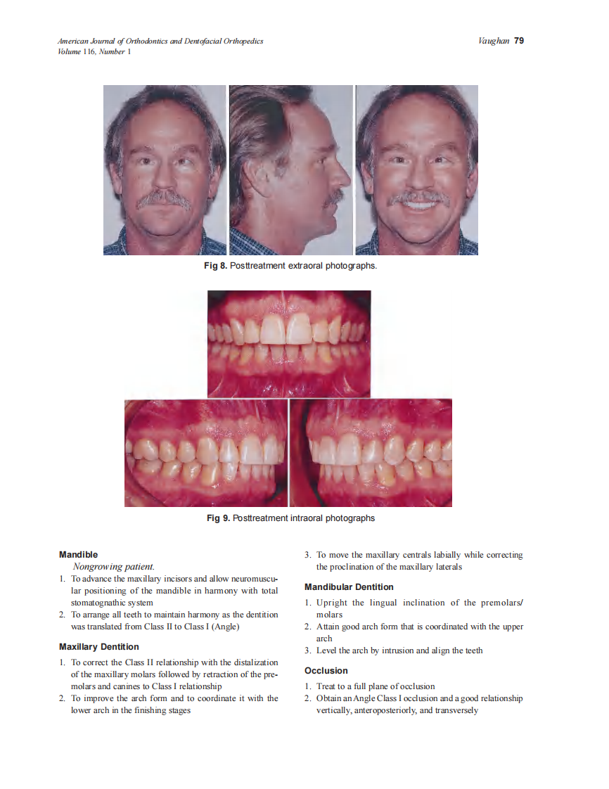 Vaughan_1999_116_1_by_OrTHoTaMiNe.pdf 第5页