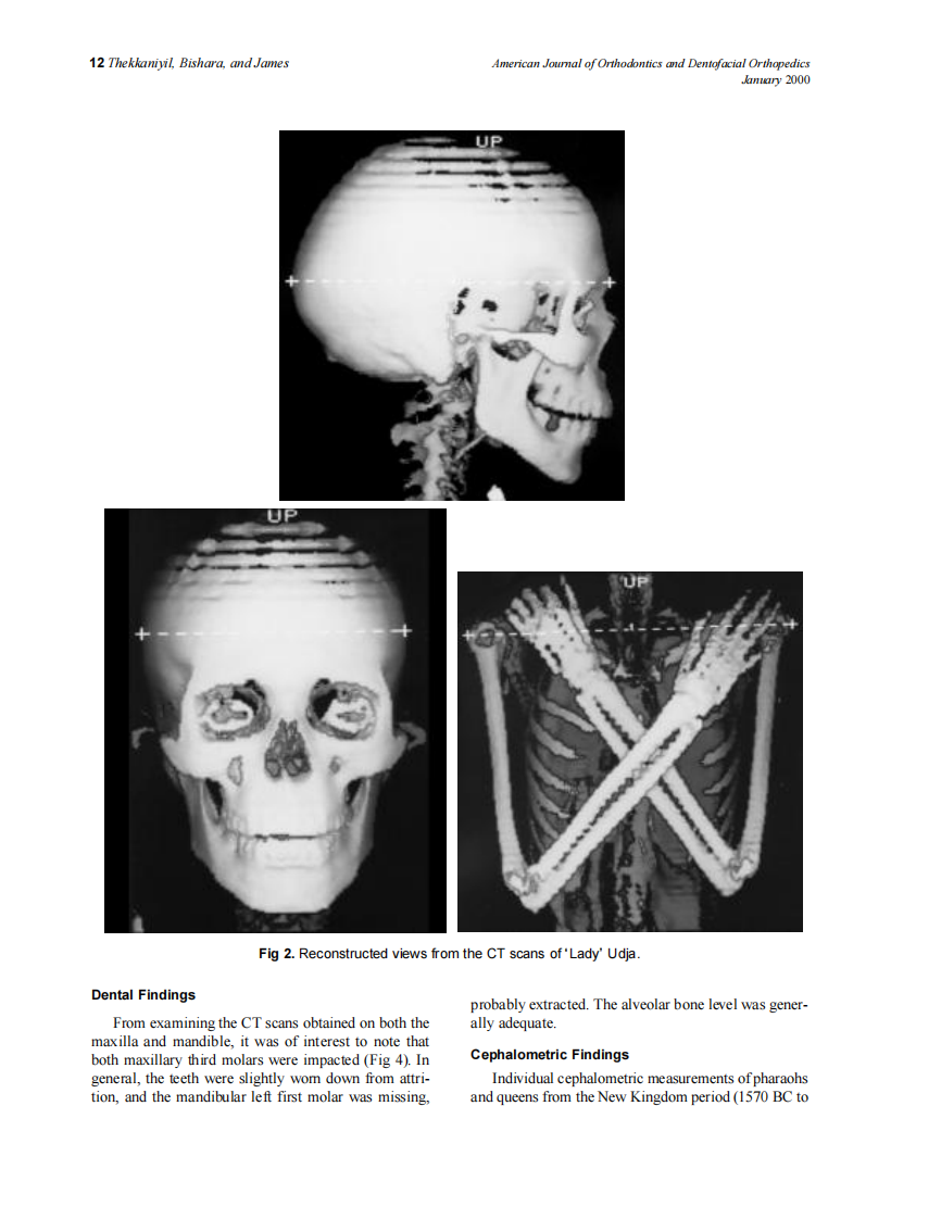 2000_117_1_10_14_Thekkaniyil.pdf 第3页
