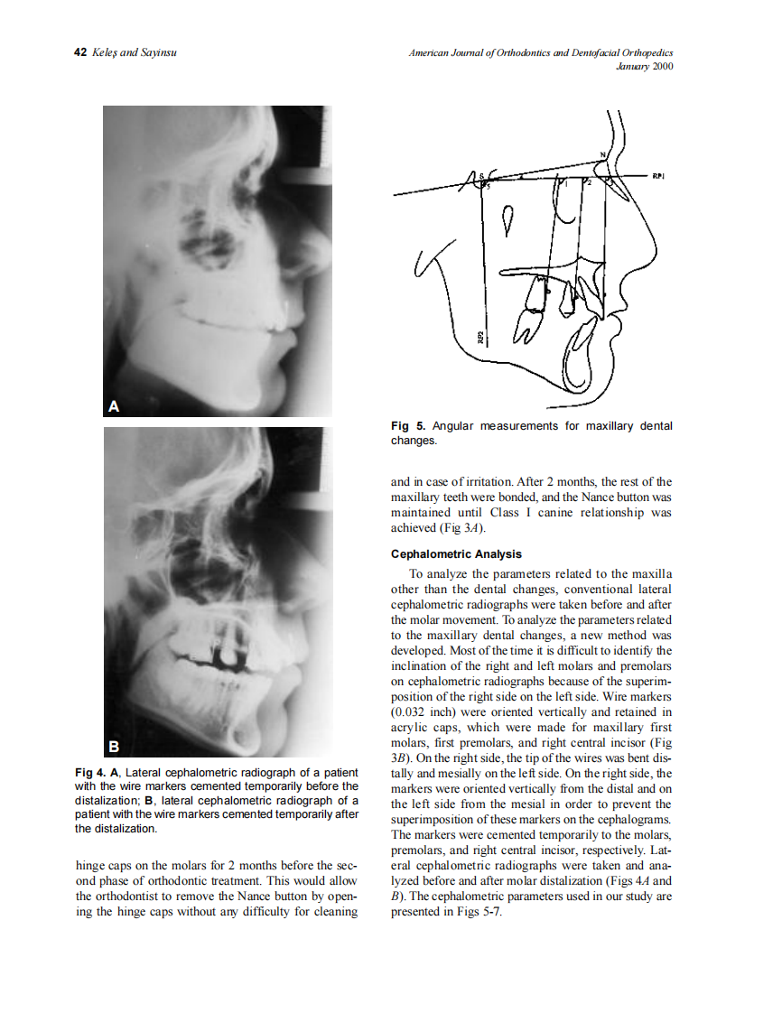 2000_117_1_39_48_Keles.pdf 第4页