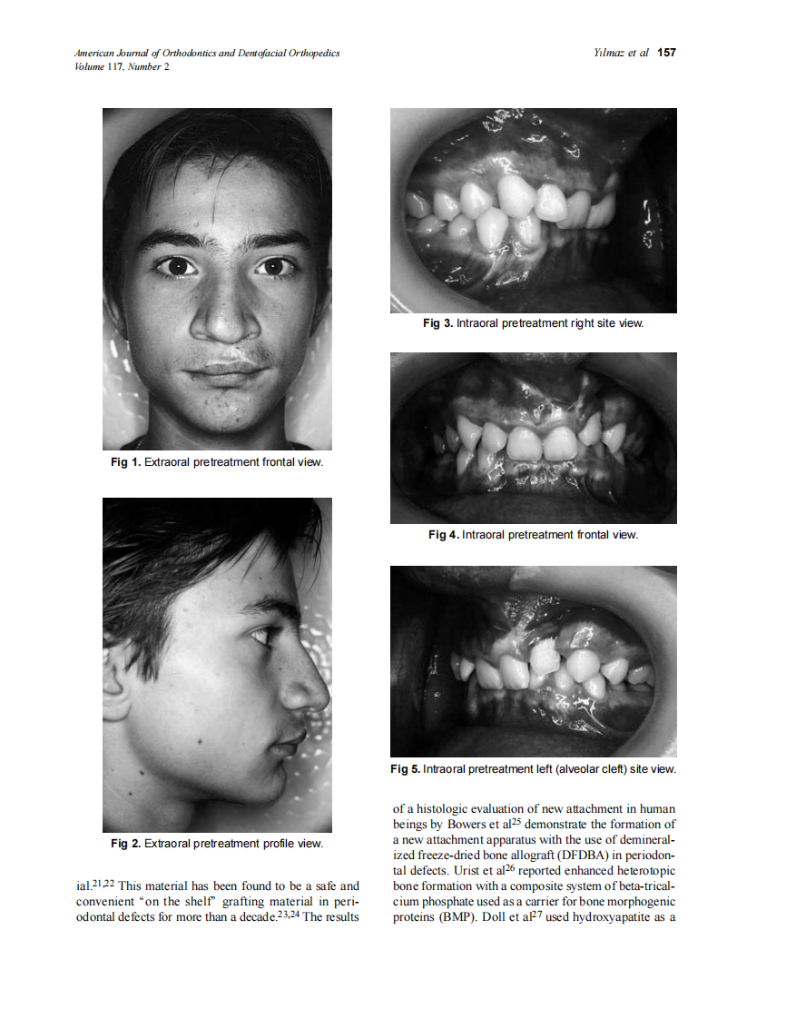 2000_117_2_156_163_Yilmaz.pdf 第2页