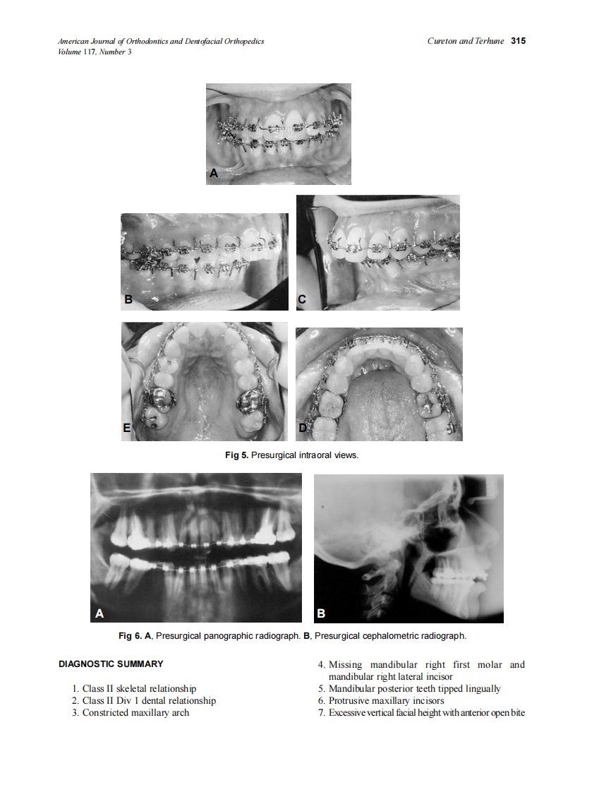 2000_117_3_312_319_Cureton.pdf 第4页